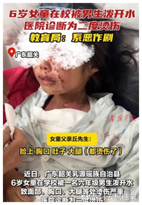 广东通报女童被泼开水事件，悲剧引发的警示与反思