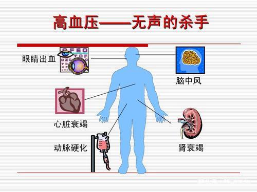 降压药使用误区解析，是否需要经常更换及合理用药策略探讨。